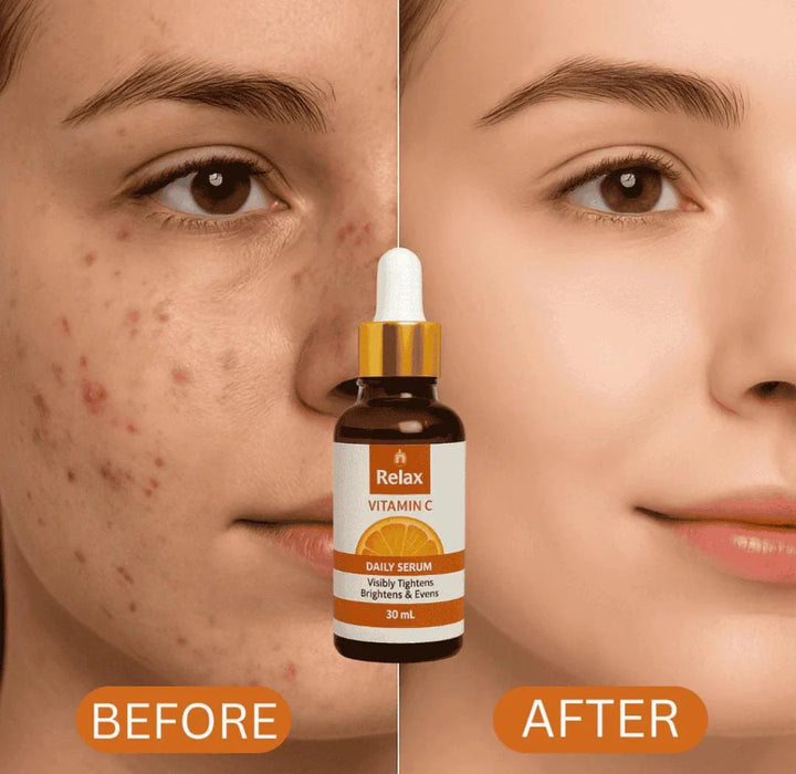 Relax Vitamin C Daily Serum ( Net Quantity: 30ml )